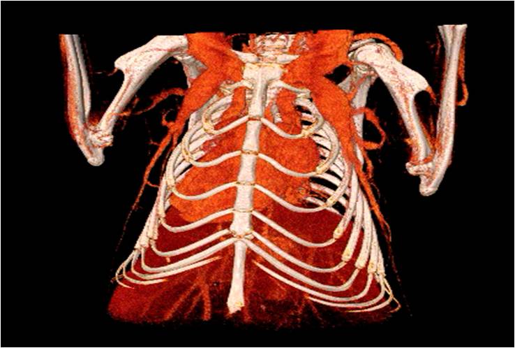 心血管1.jpg 心血管1.jpg